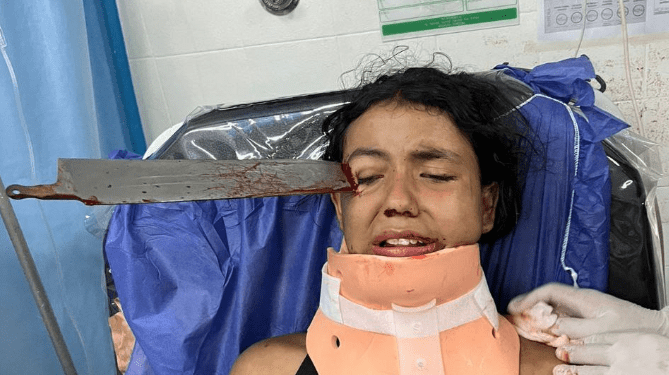 Lesionan con cuchillo a niña en Colombia